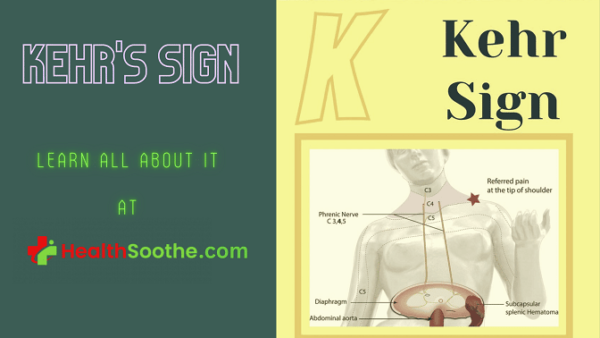 Kehr S Sign What You Need To Know About It With Pictures And Videos