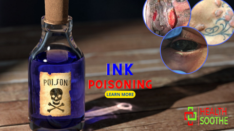 Ink Poisoning Symptoms Causes Treatment And Pictures