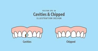 How-Will-My-Cracked-Tooth-Be-Examined