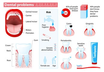 Are there ways to avoid dental problems
