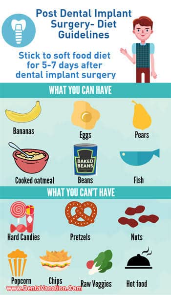 17 Best foods to eat after dental implant surgery For quick recovery
