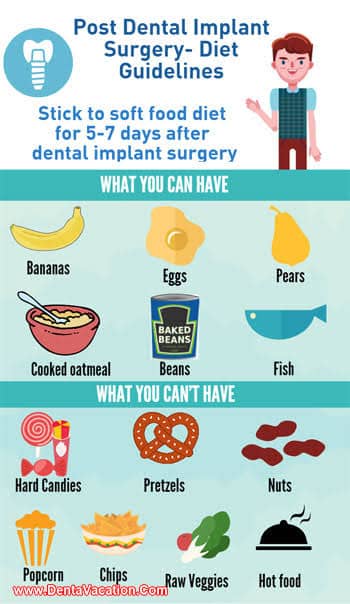 17 Best Foods To Eat After Dental Implant Surgery For Quick Recovery