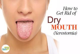 Dry Mouth Relating to Aging