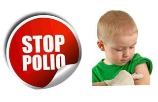 Poliomyelitis (Polio) - Symptoms, Treatment, And Prevention