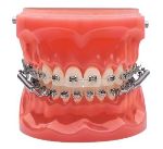 Orthodontics Appliances