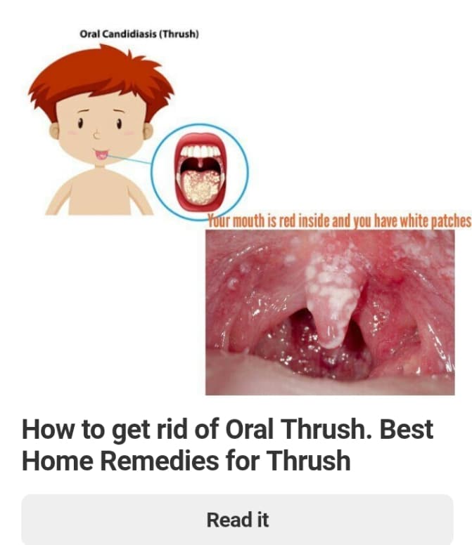 how to get rid of thrush