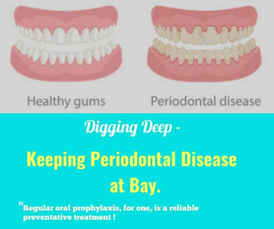 Digging Deep - Keeping Periodontal Disease At Bay