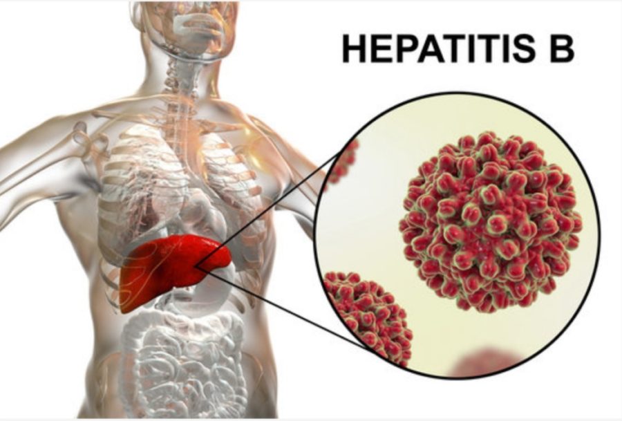 cost-of-treating-hepatitis-b-in-nigeria-2021-all-you-need-to-know