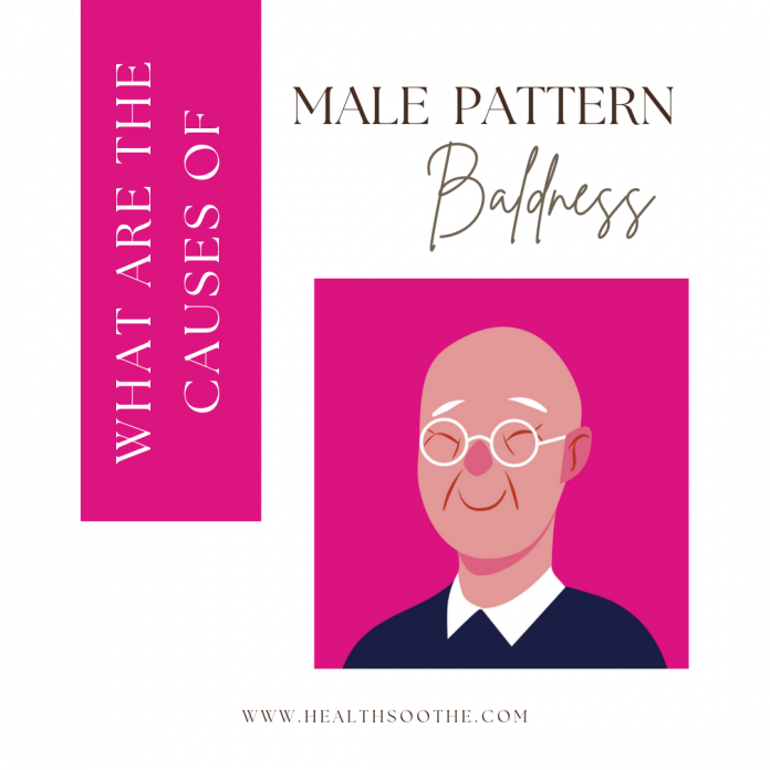 What Are The Causes Of Male Pattern Baldness