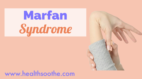 Top 13 Famous People With Marfan Syndrome You Didn’t Know About