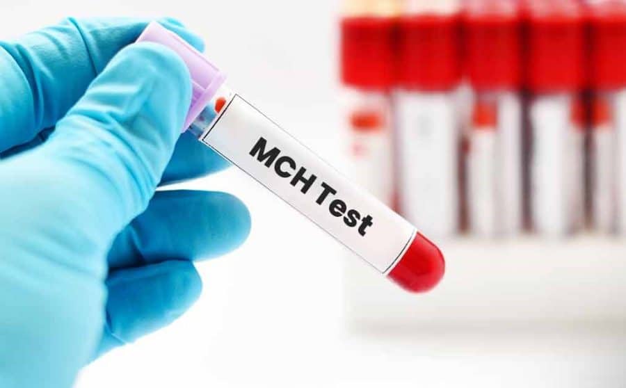 mch-blood-test-what-you-need-to-know-about-it