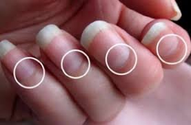 Lunula Function (Nail Problems): With Pictures, Videos, and FAQs Lunala