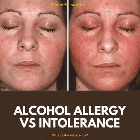 Alcohol Allergy Vs Intolerance: What's The Difference?