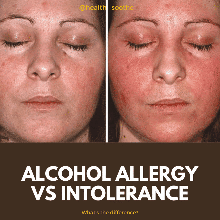 Alcohol Allergy Vs Intolerance: What'S The Difference?