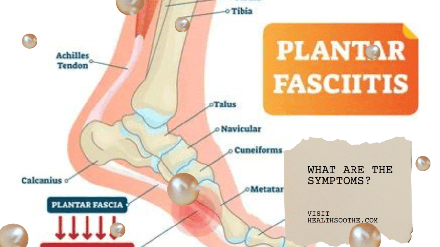 Preventing Plantar Fasciitis: Symptoms And Treatment