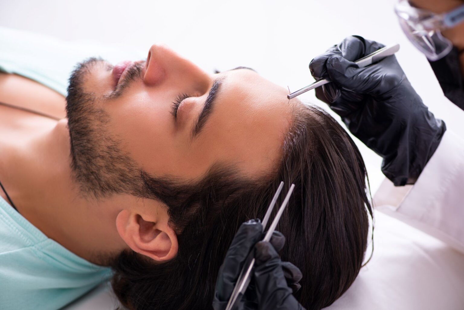 Hair Restoration For Young Adults: Is It Worth It?