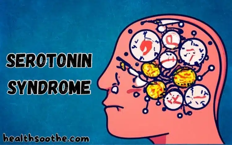 Serotonin Syndrome