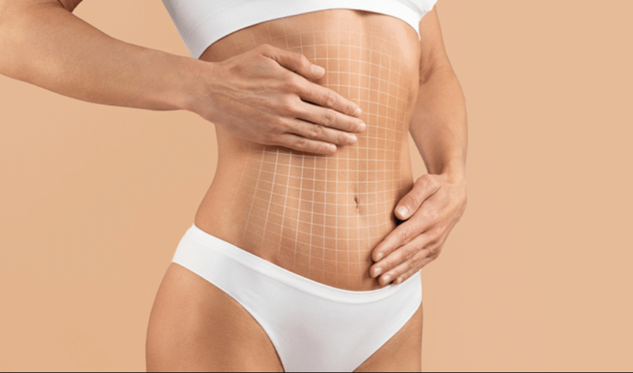 Your Guide To A Tummy Tuck: Before, During, And After